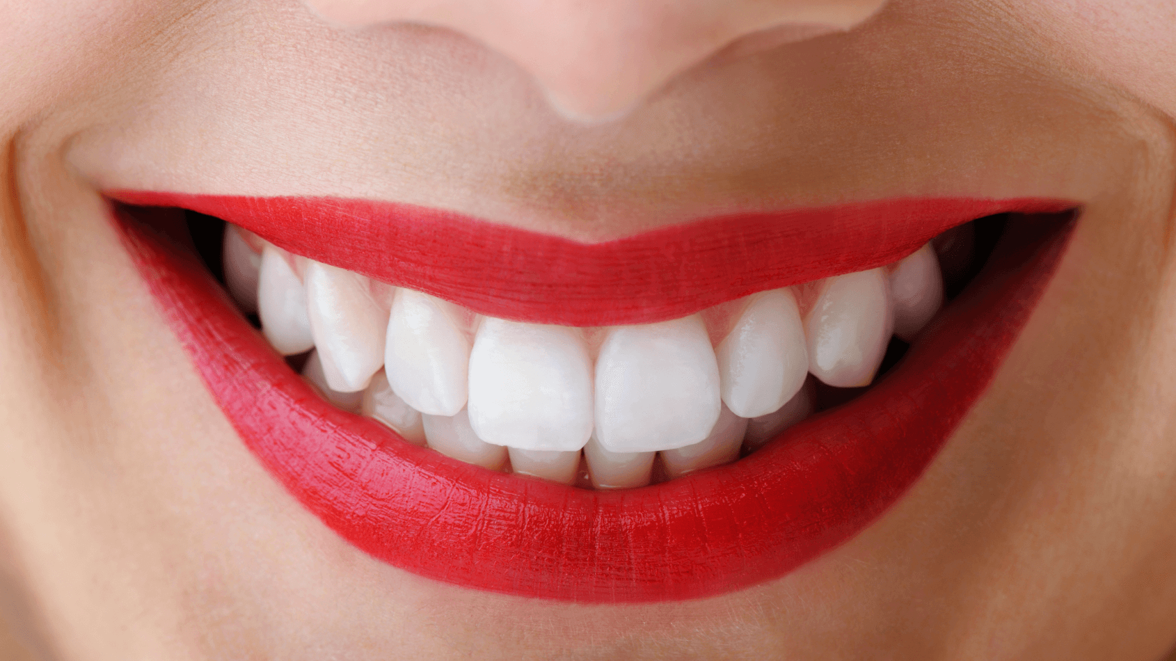 woman smiling with white teeth